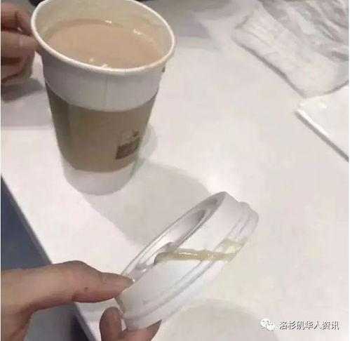 口痰图片,揭示呼吸系统健康奥秘