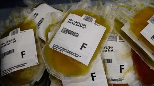 血浆照片,探索血液奥秘的视觉之旅